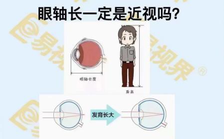 眼軸長一定是近視嗎？
